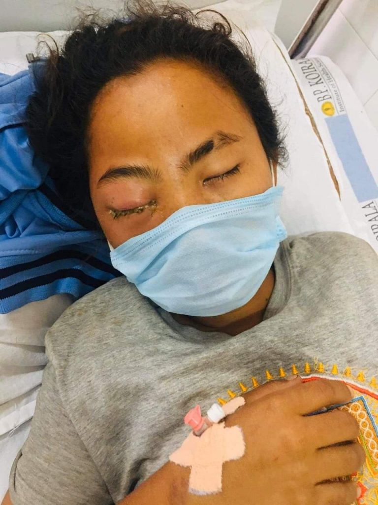 फुटबलर समीक्षाका लागि सहयोग जुटाइँदै