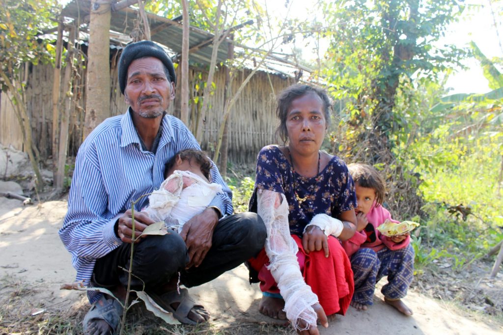 आगलागीबाट आमाछोरी घाइते