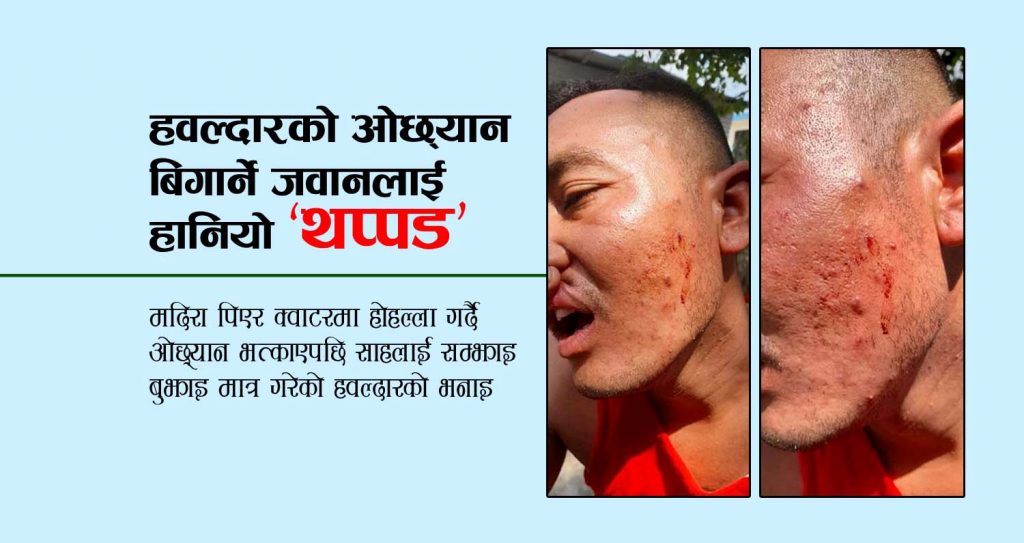 हवल्दारको ओछ्यान बिगार्ने जवानलाई हानियो ‘थप्पड’