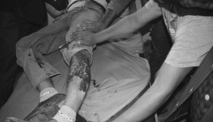 भोजपुरमा बम बिस्फोट गराउने श्रेष्ठ नै घाइते