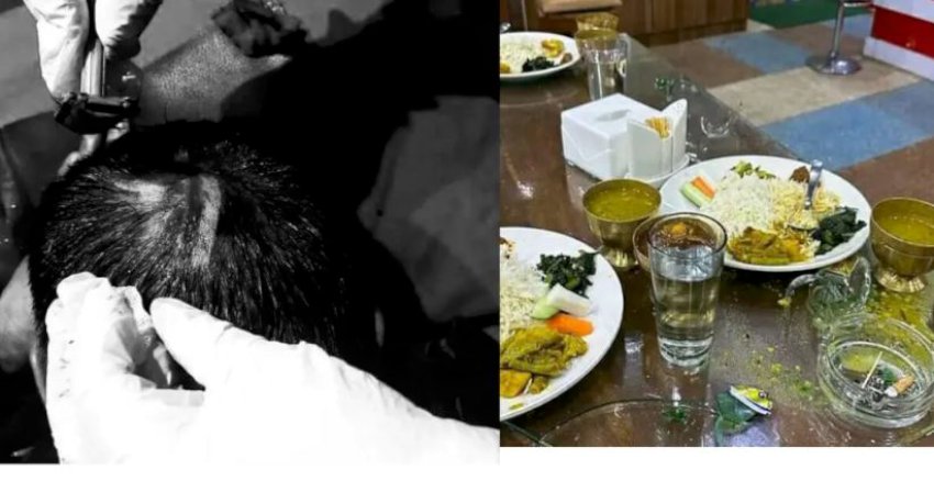 गोरखाको रिसोर्टमा एमाले कार्यकर्ताबीच कुटाकुट