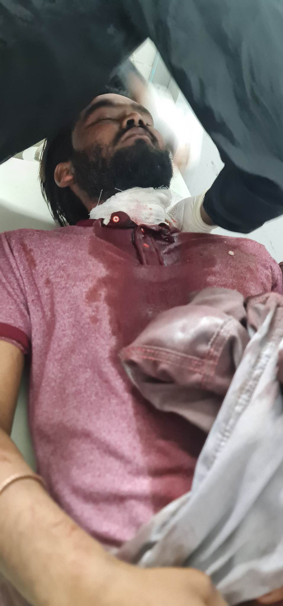 टिकुली बस्तीमा तरबार प्रहार,व्यापारी अंकित भगत गम्भीर घाइते