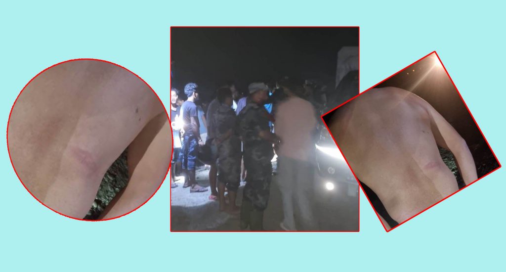 सशस्त्रको डिआइजी पोखरेलका घुमुवाको आतंक , इन्स्पेक्टर राईद्वारा डियुटिमा खटिएका चार प्रहरीमाथि निर्घात कुटपिट