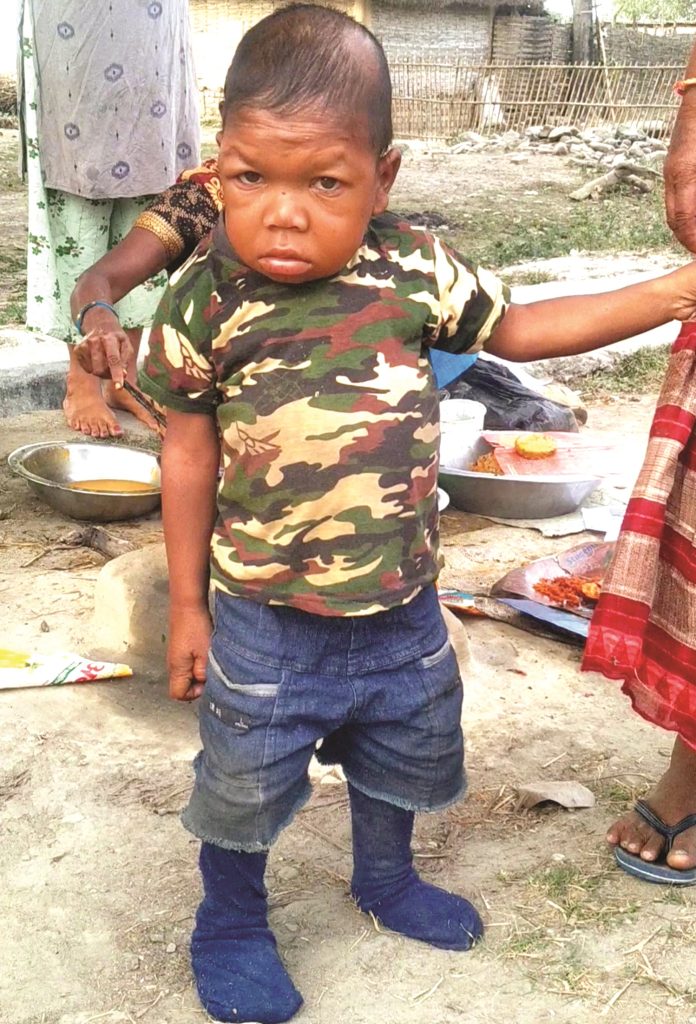 जम्मा ३१ इञ्च उचाईका सरदार