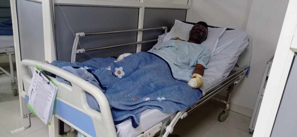 उर्लाबारी आगलागी : केही घाइतेको अवस्था गम्भीर