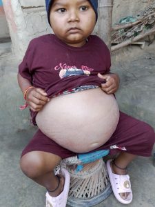 भूमिहीन श्रमिकलाई छोराको उपचार गर्नै सकस