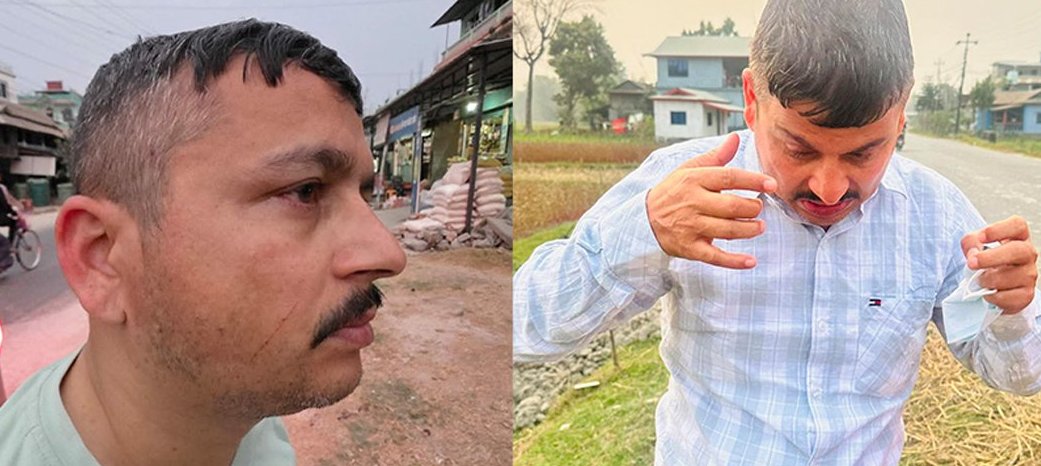 हाम्रोमतका कार्यकारी सम्पादक आचार्यमाथि एमाले कार्यकर्ताद्वारा आक्रमण