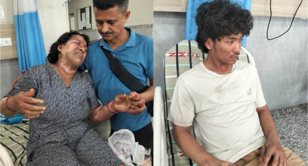 विराटनगरमा आमाले शरिरमा लगाएको आगो निभाउने क्रममा दुबै घाइते